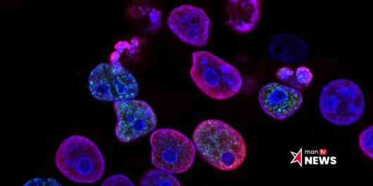 Research study on endometrial cancer genetics