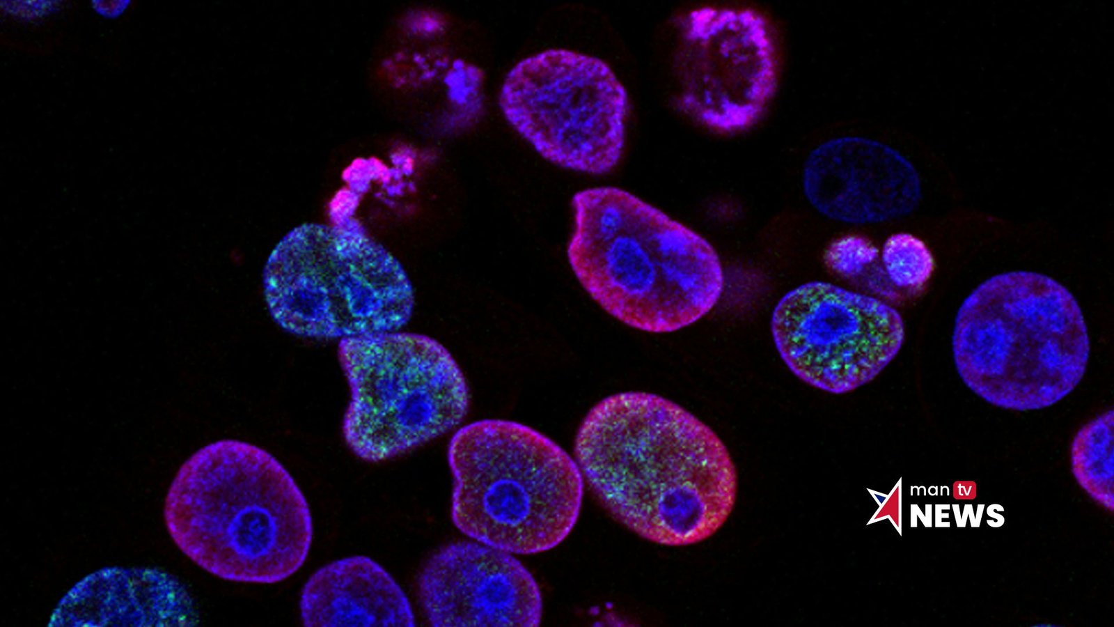 Research study on endometrial cancer genetics