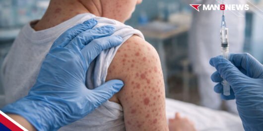 Measles alert public health warning NSW
